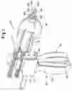 Fig. 02 - Bone marrow mixing instrument