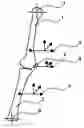 Fig. 01 - System for determining the position of a knee prosthesis