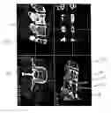 Fig. 01 - Functional image-guided placement of bone screws, path optimization and orthopedic surgery