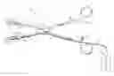 Fig. 01 - Vascular clamp for caesarian section