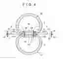 Fig. 05 - Blood vessel anastomosing appliance