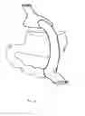 Fig. 04 - Method and device for use in endoscopic organ procedures
