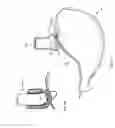 Fig. 05 - Method and device for use in endoscopic organ procedures