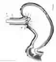 Fig. 07 - Method and device for use in endoscopic organ procedures