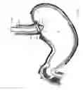 Fig. 08 - Method and device for use in endoscopic organ procedures