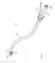 Fig. 13 - Method and device for use in endoscopic organ procedures