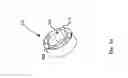 Fig. 15 - Method and device for use in endoscopic organ procedures