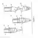 Fig. 05 - Method and apparatus for improving success rate of blood yield from a fingerstick