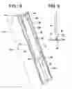 Fig. 06 - Medical device anchor and delivery system