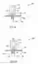 Fig. 02 - Method and apparatus for forming apertures in blood vessels