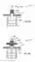 Fig. 14 - Method and apparatus for forming apertures in blood vessels