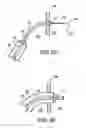 Fig. 06 - Transseptal puncture apparatus