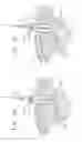 Fig. 09 - Minimal access lumbar diskectomy instrumentation and method