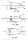 Fig. 17 - Embolic filter frame having looped support strut elements