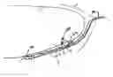 Fig. 01 - Perficardial pacing lead placement device and method