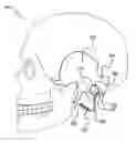 Fig. 01 - Skull-mounted electrical stimulation system