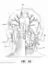 Fig. 03 - Skull-mounted electrical stimulation system