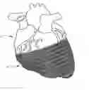Fig. 01 - Method of manufacturing a cardiac harness