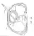 Fig. 17 - Method of manufacturing a cardiac harness