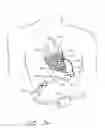 Fig. 32 - Method of manufacturing a cardiac harness