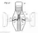 Fig. 03 - Endovascular prosthesis, system and method
