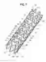 Fig. 02 - Stent-graft with rails