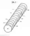 Fig. 04 - Stent-graft with rails