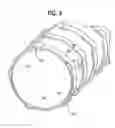 Fig. 05 - Stent-graft with rails