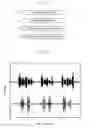 Fig. 02 - Speaking period detection device, voice recognition processing device, transmission system, signal level control device and speaking period detection method