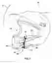 Fig. 02 - Auxiliary securing strap for use with a helmet having a primary chin strap and an integral front chin-guard portion