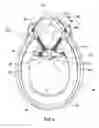 Fig. 06 - Auxiliary securing strap for use with a helmet having a primary chin strap and an integral front chin-guard portion