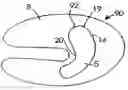 Fig. 01 - Device and method for protecting an ear of a subject from auricular haematoma
