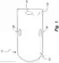 Fig. 02 - Method and device for inserting a pillow into a pillowcase
