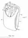 Fig. 04 - Universal dispenser for dispensing of laundry additives during automatic machine laundering of fabrics
