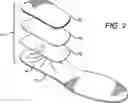 Fig. 03 - Customized orthopedic sole-insert and method for making