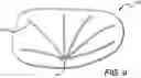 Fig. 10 - Customized orthopedic sole-insert and method for making
