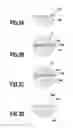 Fig. 04 - Recovery processing method of an electrode