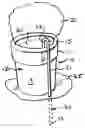 Fig. 01 - Retainer for preventing tipping of flower pot