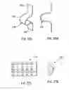 Fig. 22 - Keying system and method