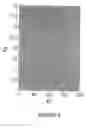 Fig. 03 - Water cooled panel and forming method