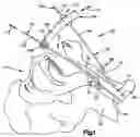 Fig. 02 - Medical device positioning system and method