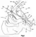 Fig. 04 - Medical device positioning system and method