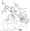 Fig. 09 - Medical device positioning system and method