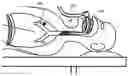 Fig. 01 - Methods, systems & devices for endobronchial ventilation and drug delivery