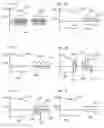 Fig. 05 - Methods, systems & devices for endobronchial ventilation and drug delivery