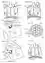 Fig. 11 - Methods, systems & devices for endobronchial ventilation and drug delivery