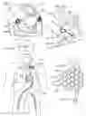 Fig. 12 - Methods, systems & devices for endobronchial ventilation and drug delivery