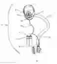 Fig. 01 - Breath responsive filter blower respirator system