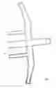 Fig. 06 - Nasal and oral cannula having two capabilities and method of producing same