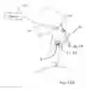 Fig. 12 - Nasal and oral cannula having two capabilities and method of producing same